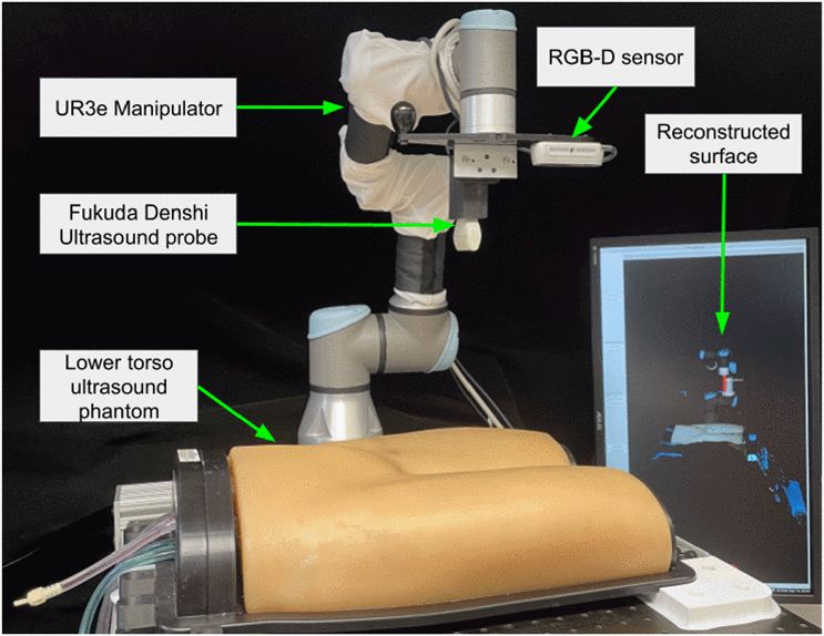 Robotic Ultrasound setup